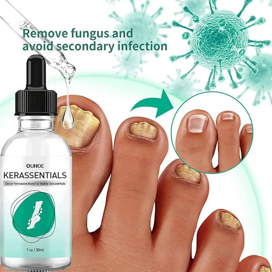 Toe Nail Fungus Support